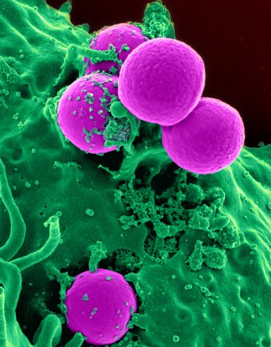 Legionella